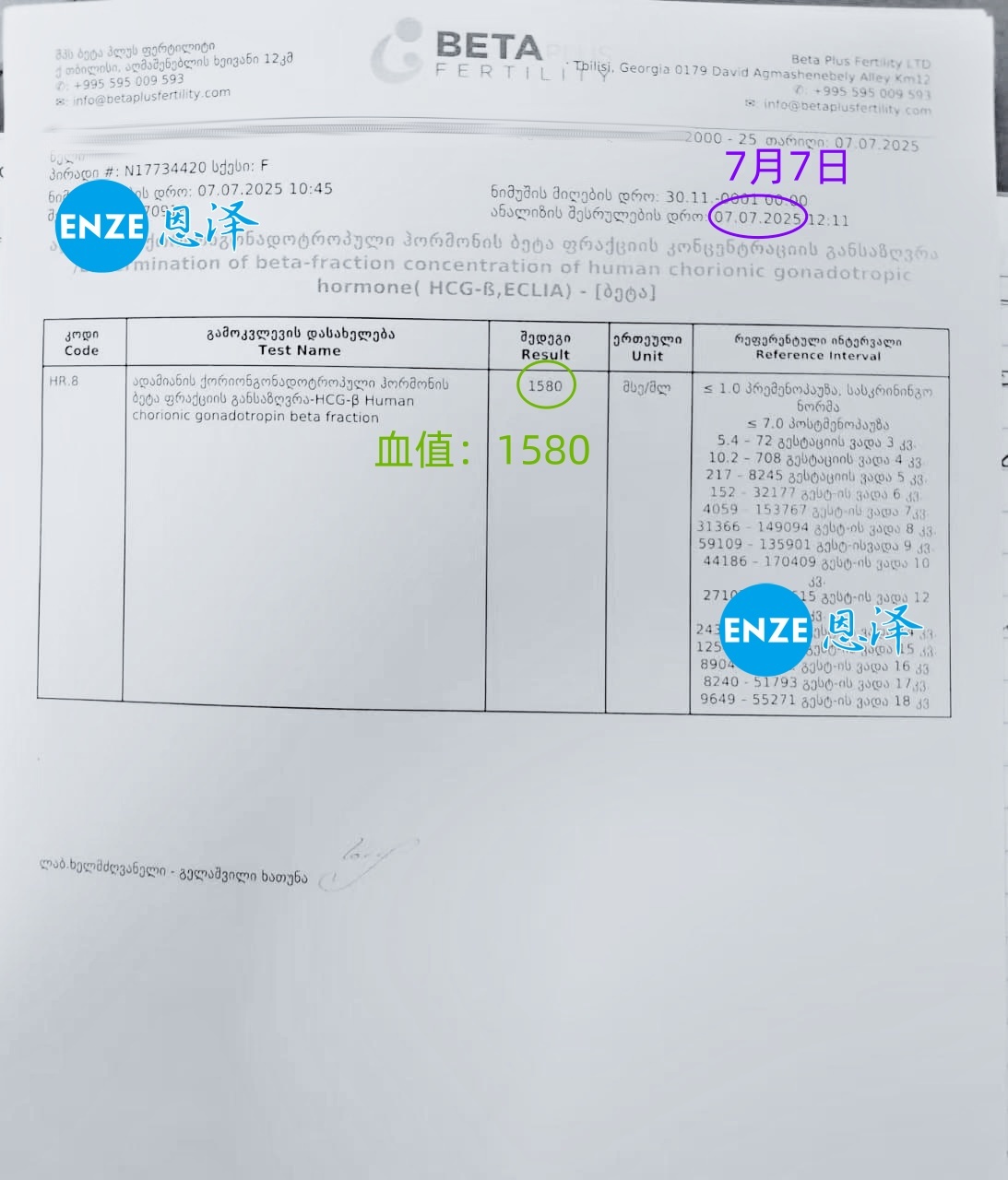 恩泽格鲁吉亚代孕代母验孕成功