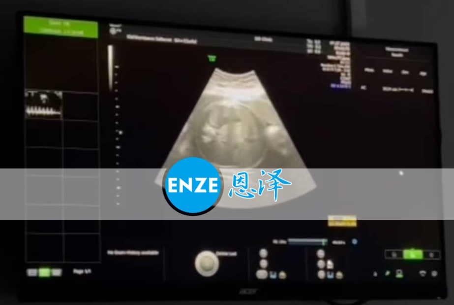 恩泽格鲁吉亚代孕代母32周检查顺利通过