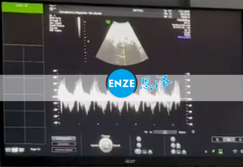 恩泽格鲁吉亚代孕代母32周检查顺利通过