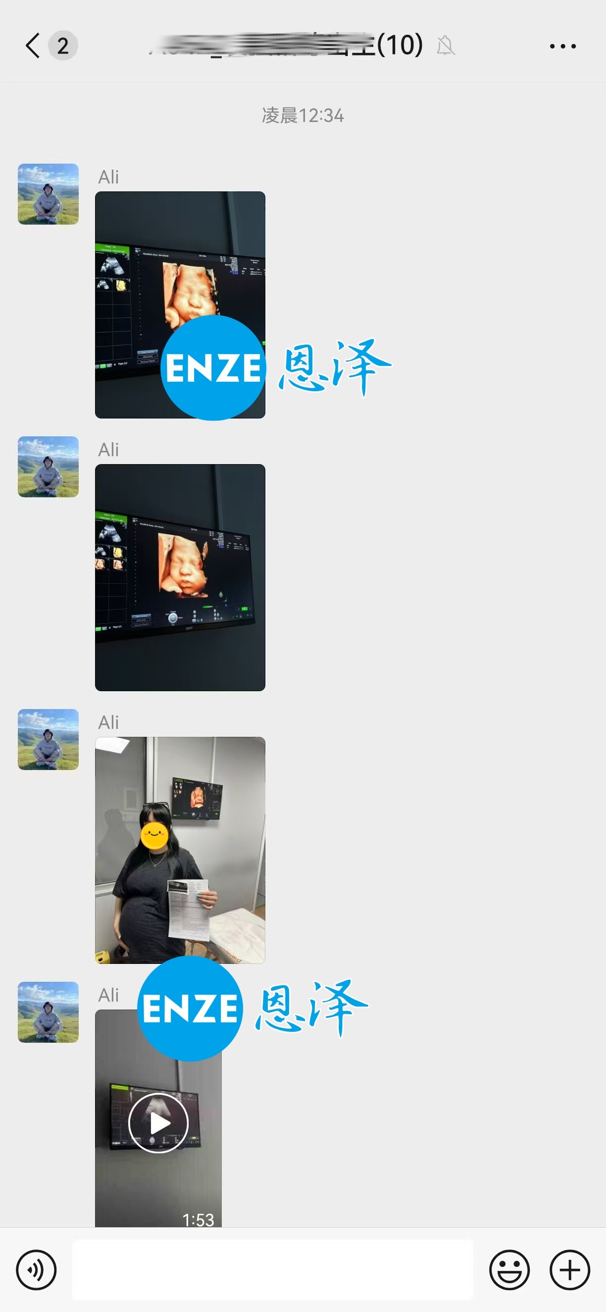 恩泽格鲁吉亚代孕代母33周检查顺利通过
