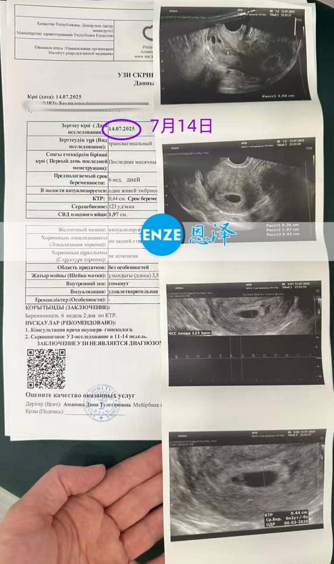恩泽哈萨克斯坦代孕代母6周检查顺利通过