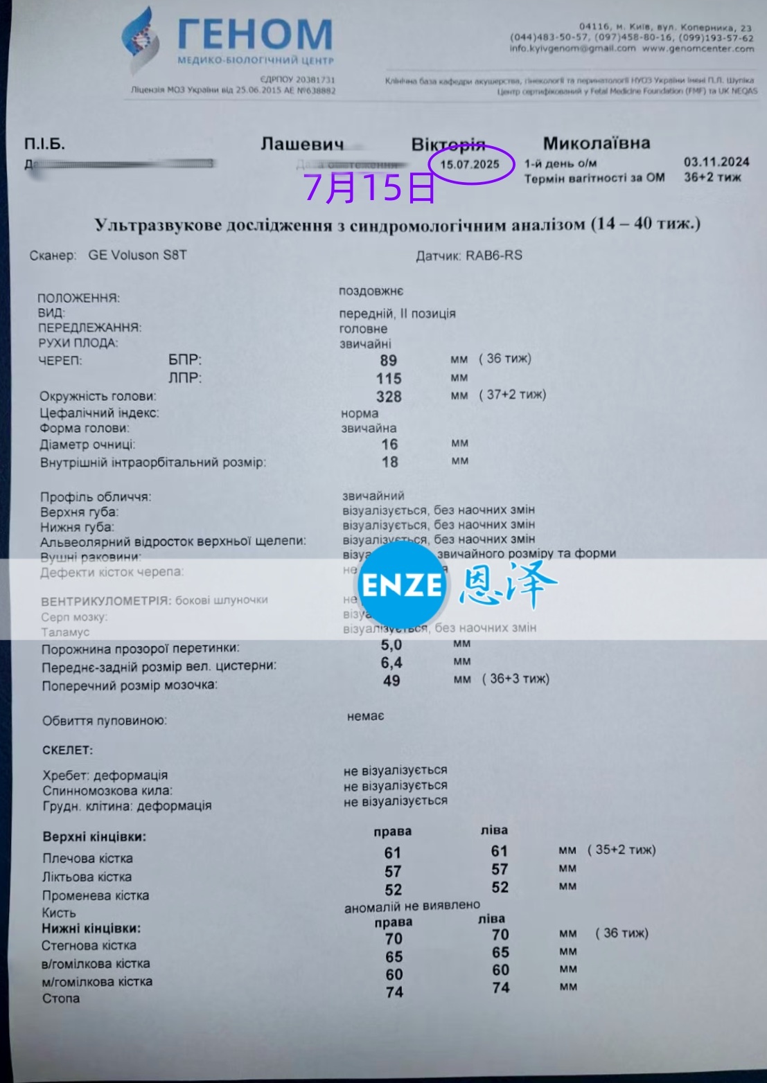 恩泽乌克兰代孕代母36周检查顺利通过