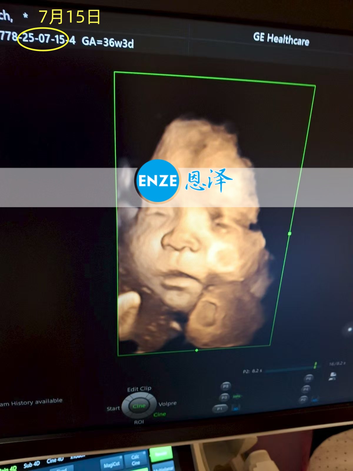 恩泽乌克兰代孕代母36周检查顺利通过