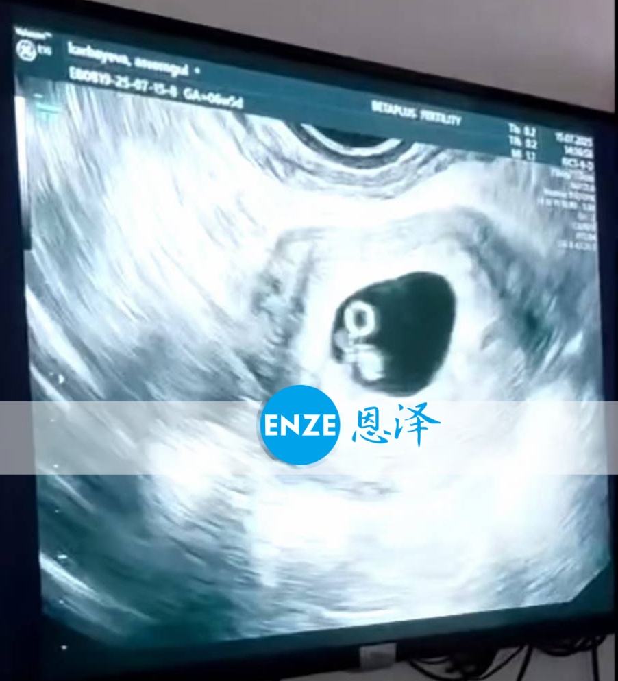 恩泽格鲁吉亚代孕代母6周检查顺利通过