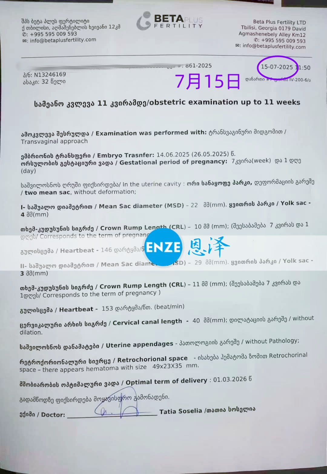 恩泽格鲁吉亚代孕代母7周检查顺利通过
