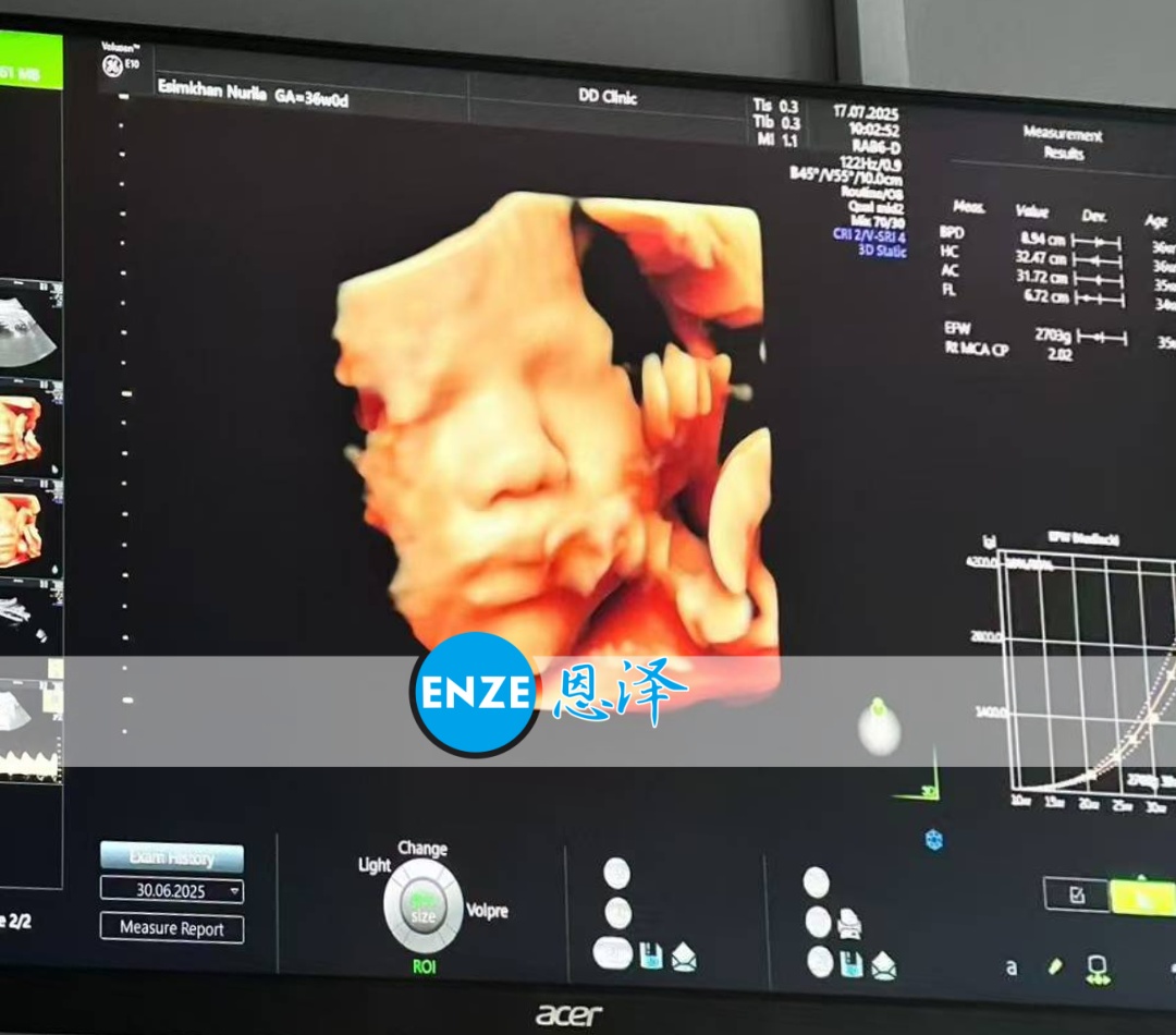 恩泽格鲁吉亚代孕代母36周检查顺利通过