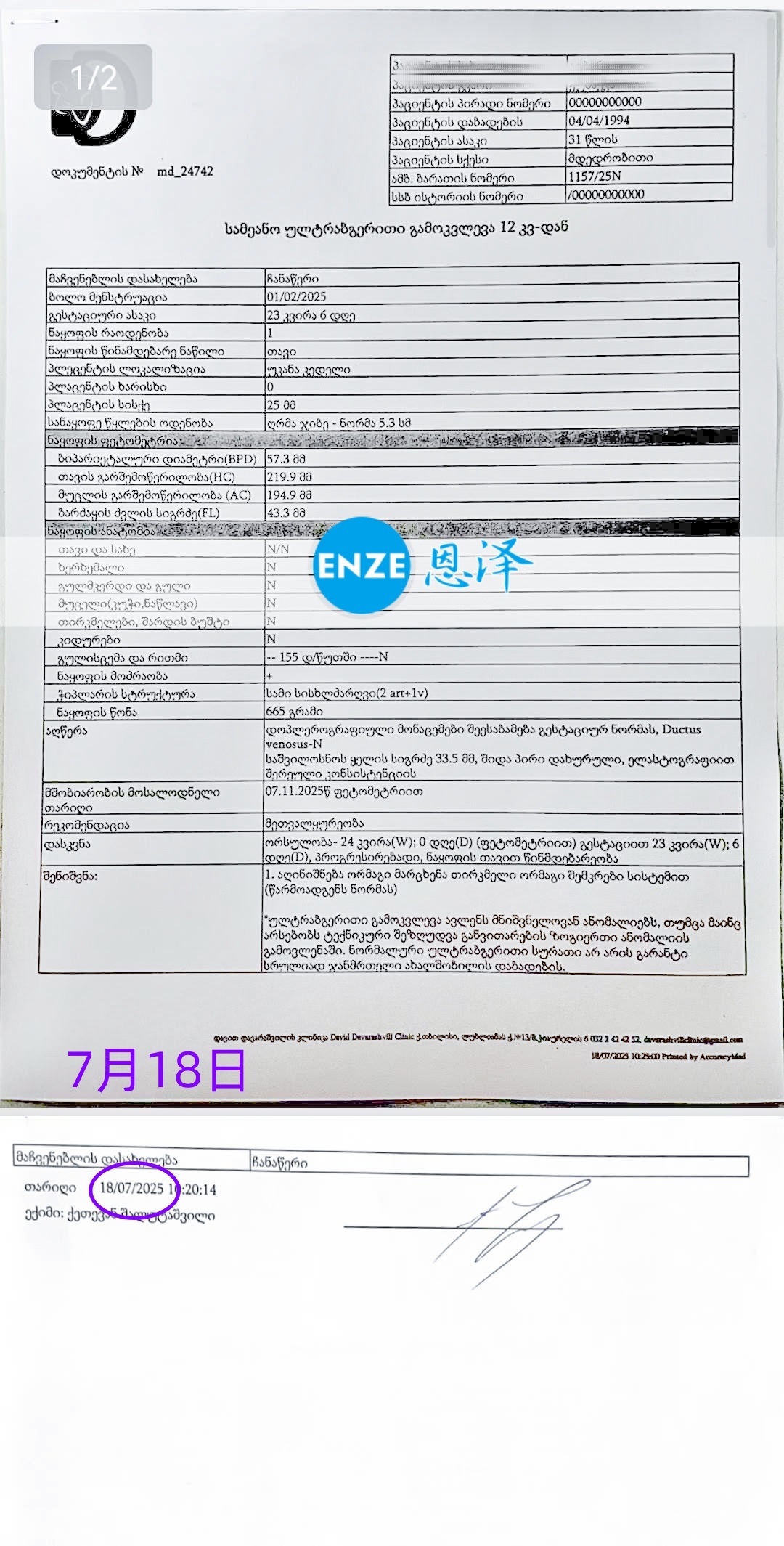 恩泽格鲁吉亚代孕代母23周检查顺利通过