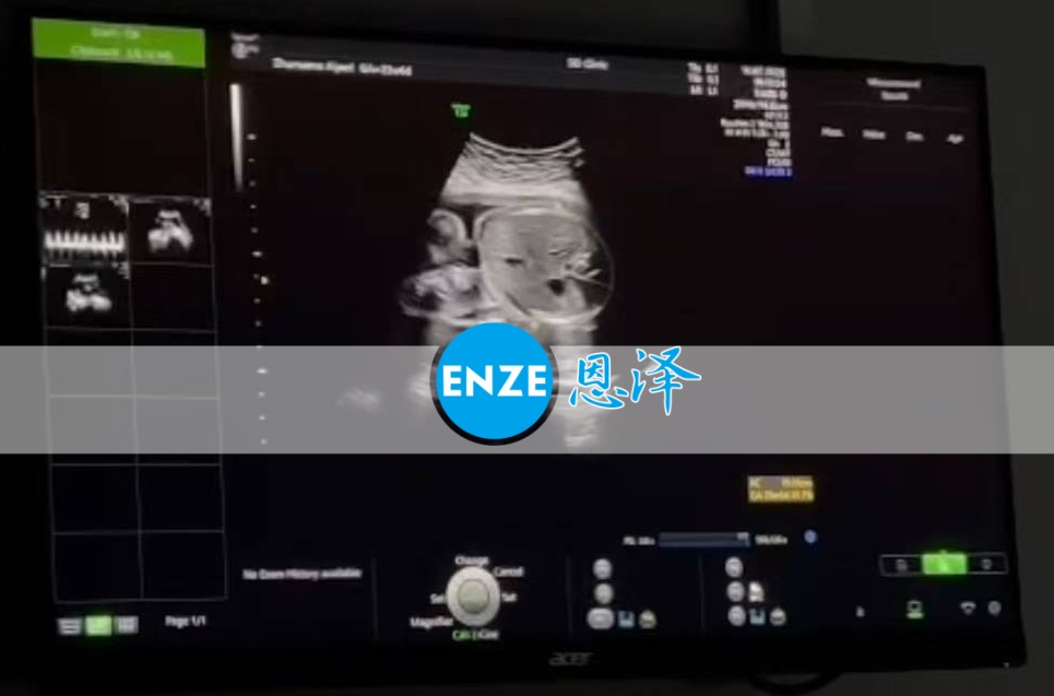 恩泽格鲁吉亚代孕代母23周检查顺利通过
