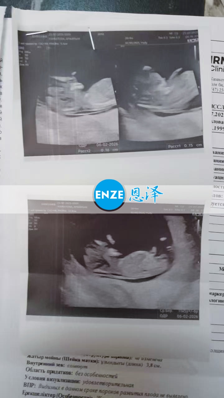 恩泽哈萨克斯坦代孕代母12周检查顺利通过