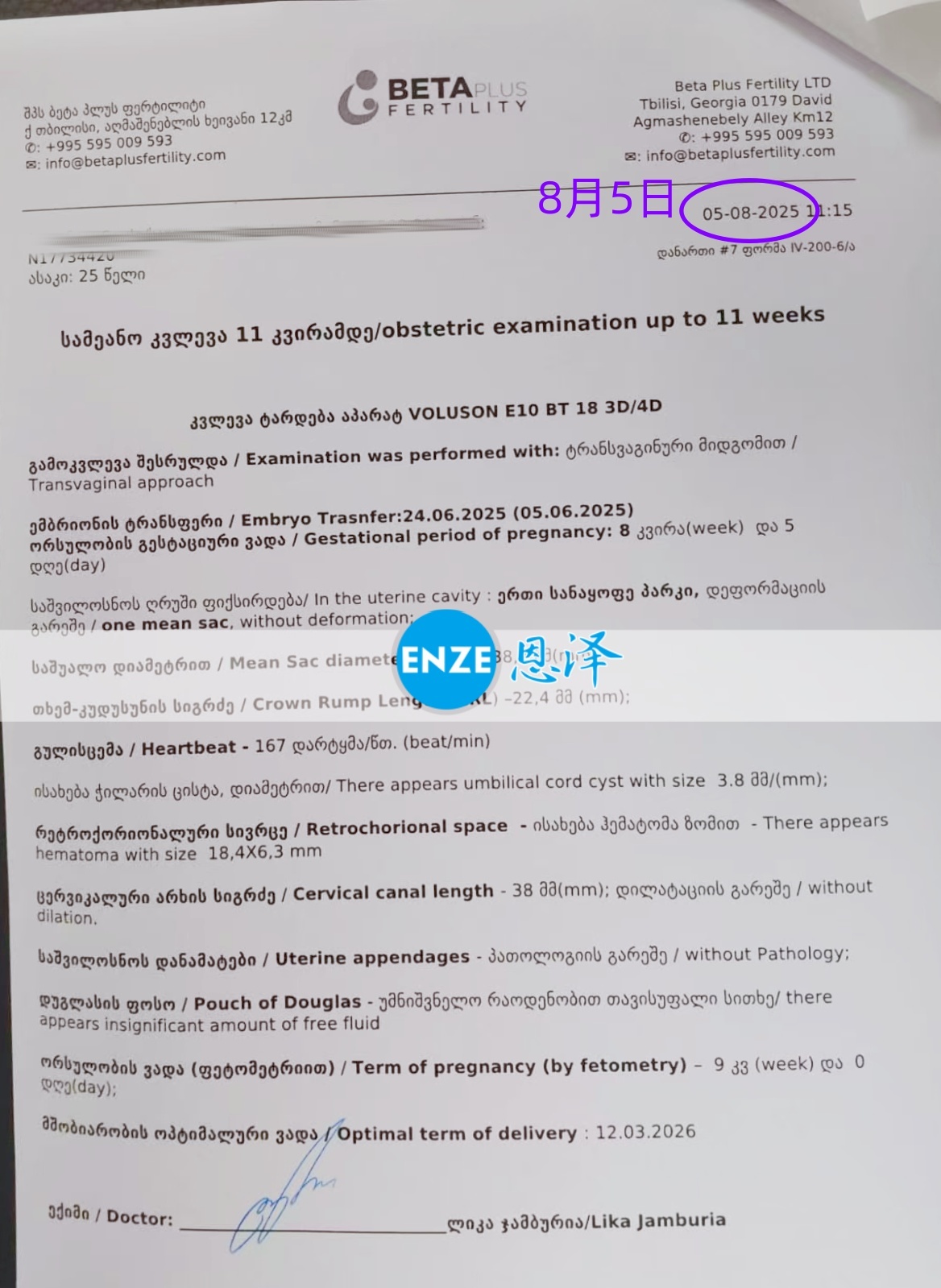恩泽格鲁吉亚代孕代母8周检查顺利通过