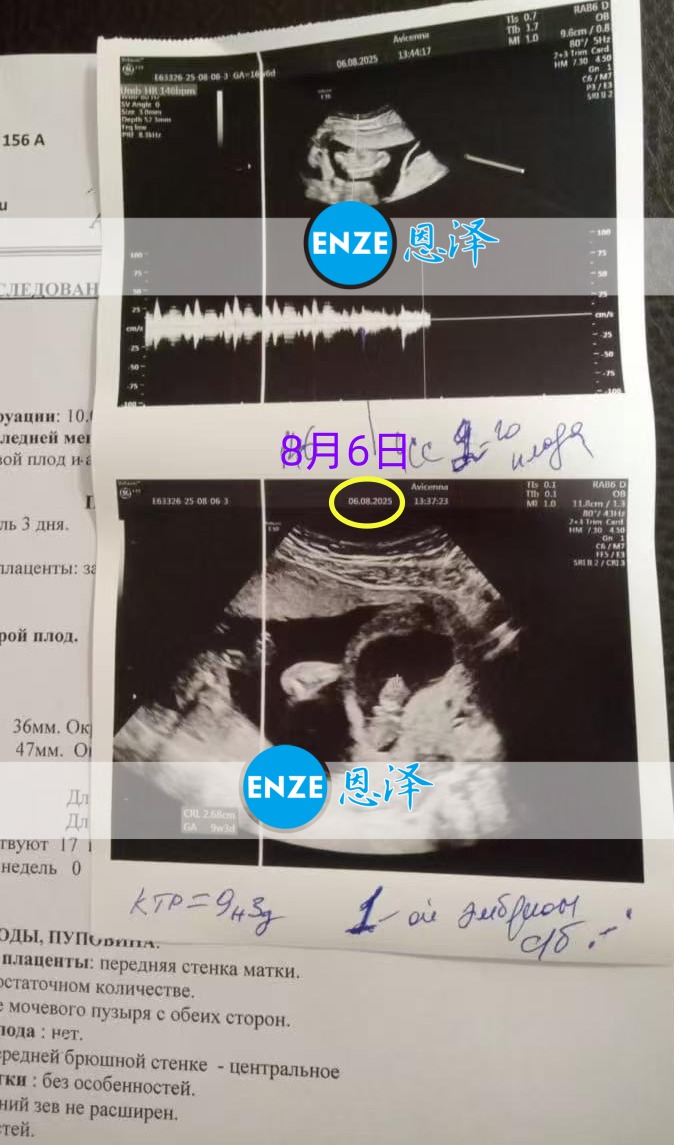 恩泽格鲁吉亚代孕代母17周检查顺利通过