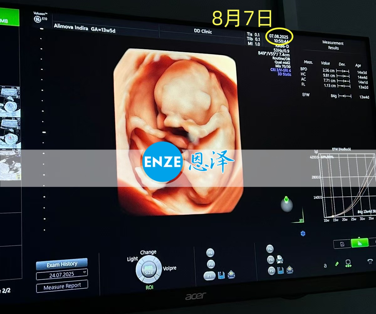 恩泽格鲁吉亚代孕代母13周检查顺利通过