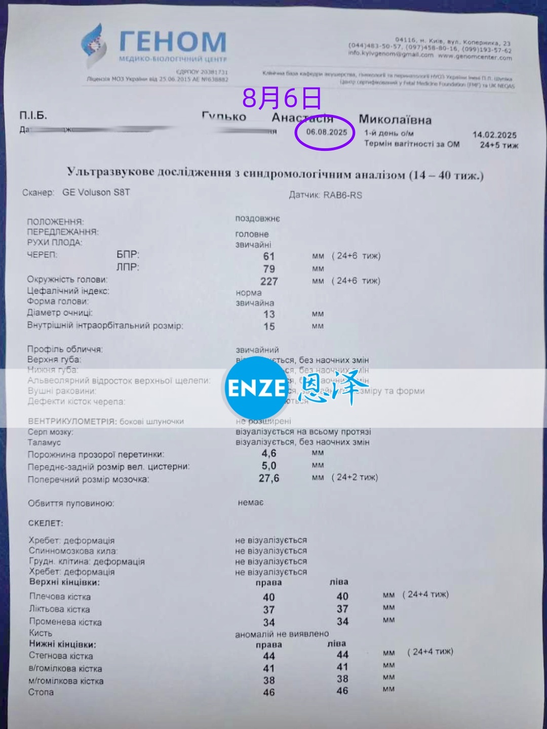 恩泽乌克兰代孕代母24周检查顺利通过