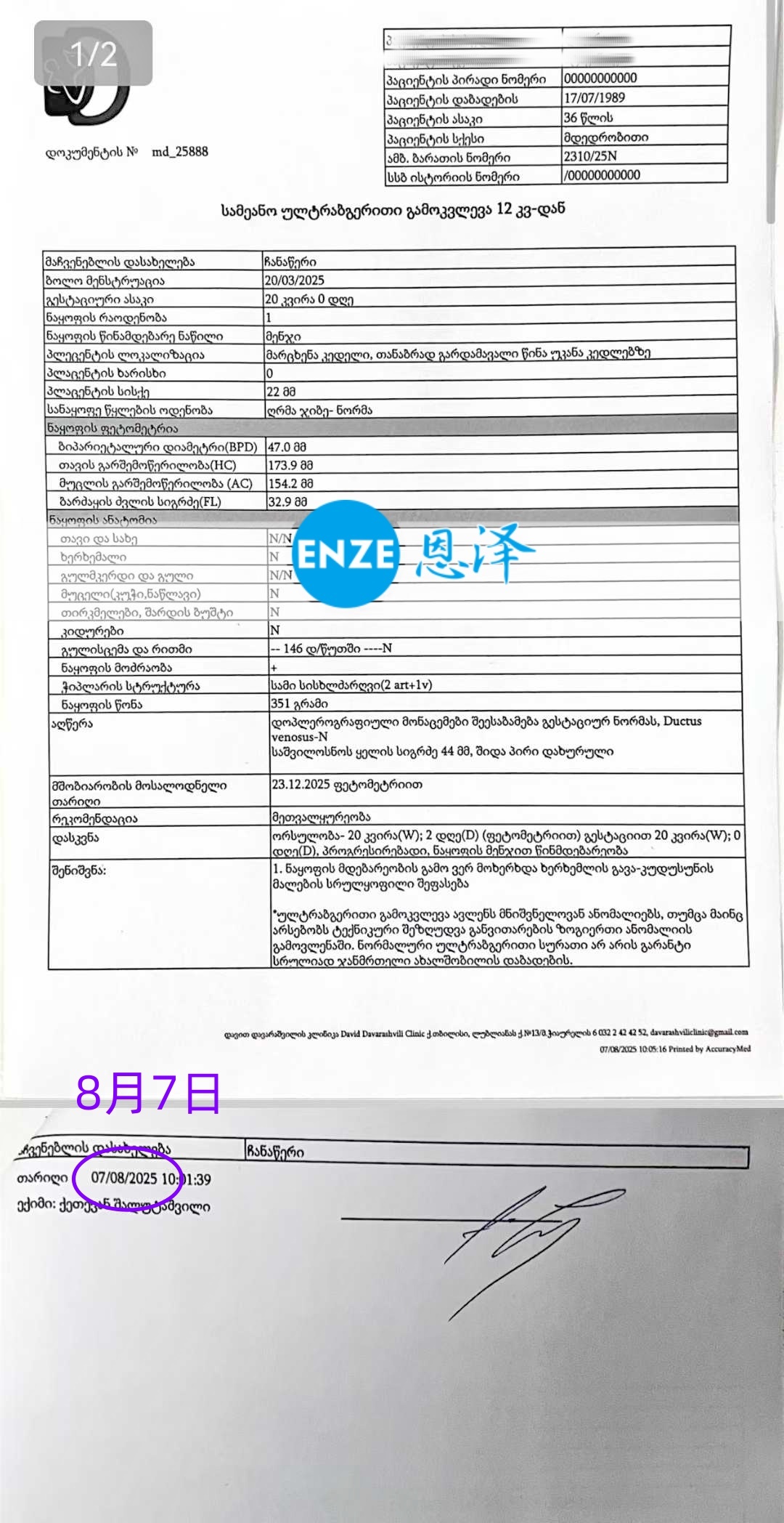 恩泽格鲁吉亚代孕代母20周检查顺利通过