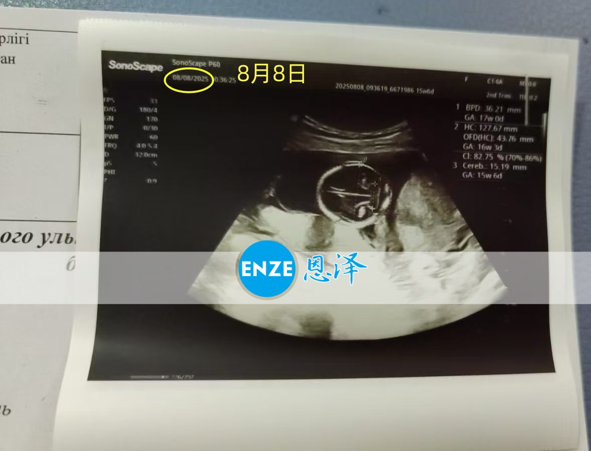 恩泽格鲁吉亚代孕代母16周检查顺利通过