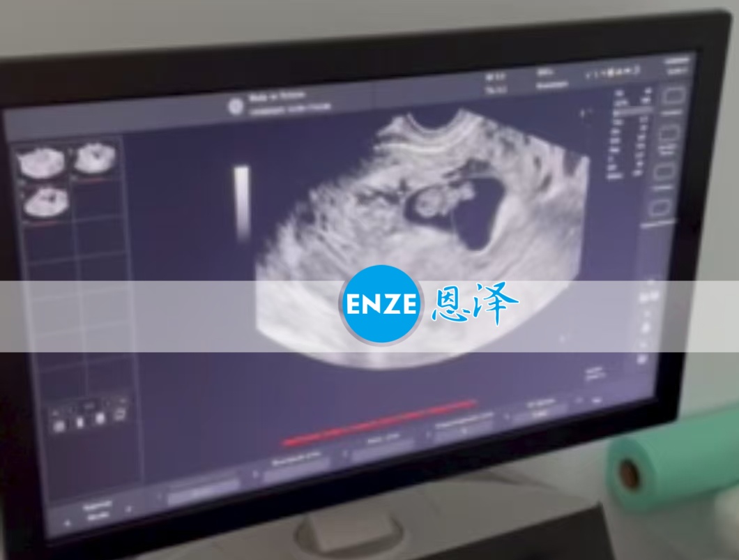 恩泽格鲁吉亚代孕代母8周检查顺利通过