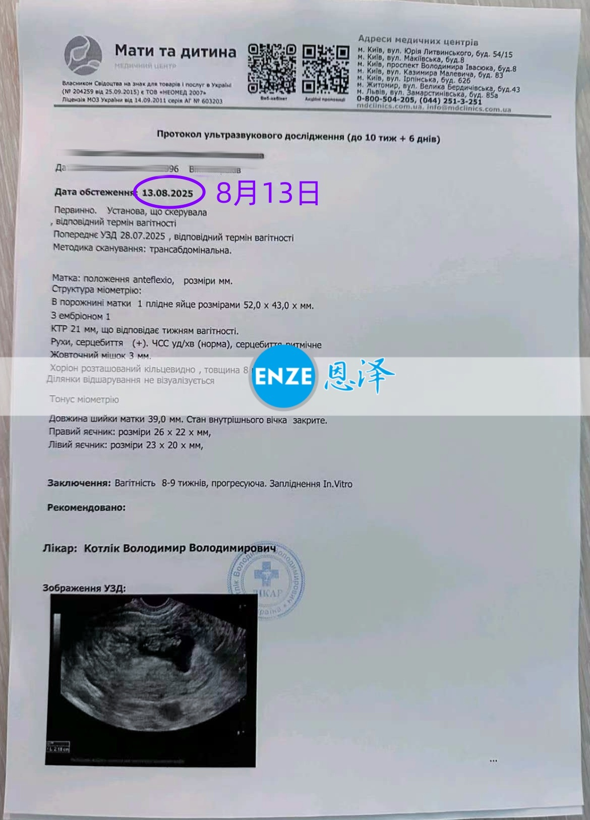 恩泽格鲁吉亚代孕代母8周检查顺利通过