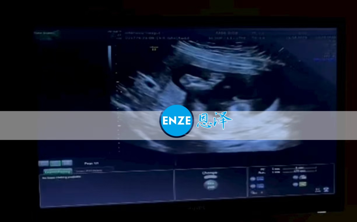 恩泽格鲁吉亚代孕代母15周检查顺利通过