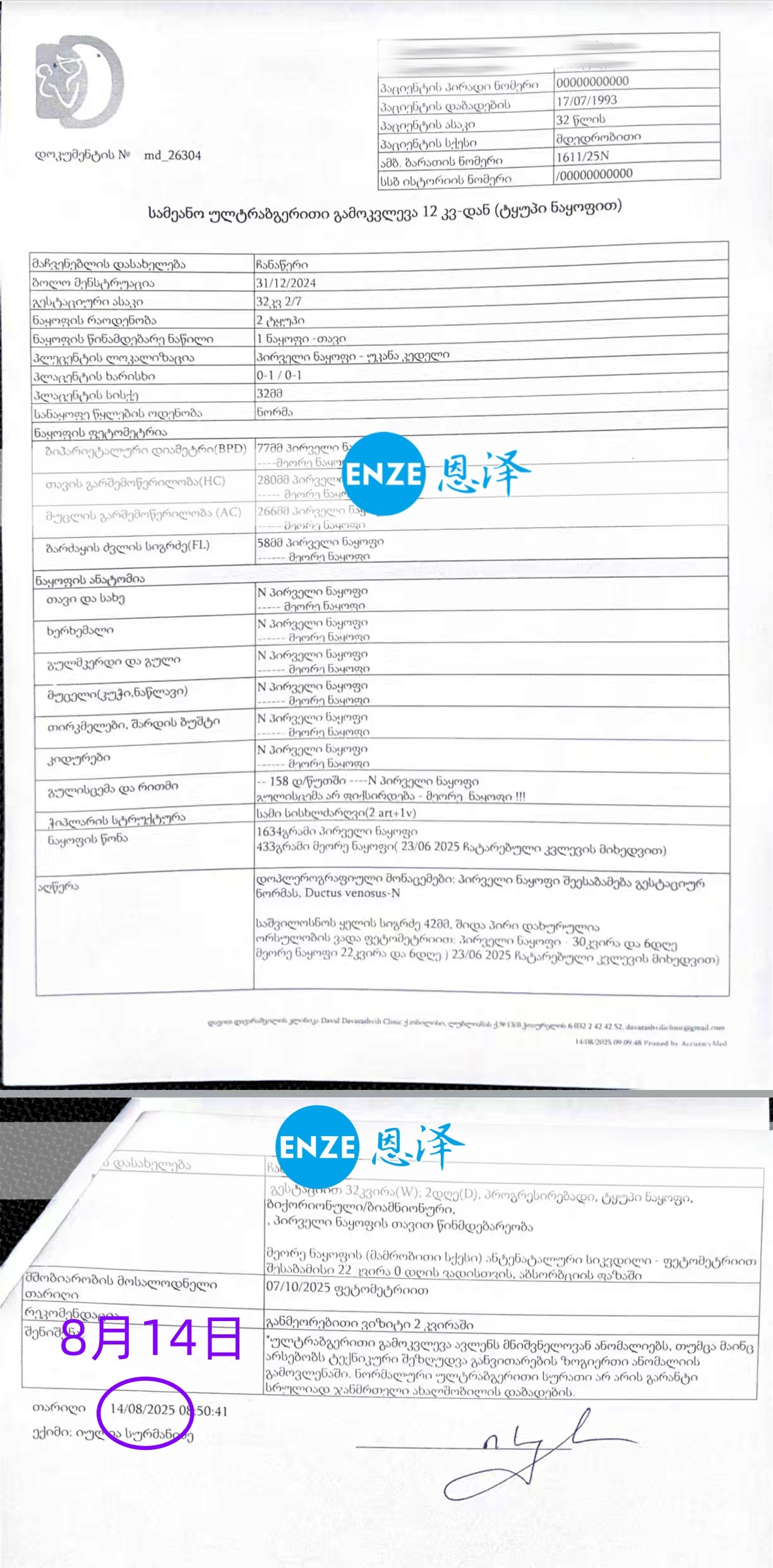 恩泽格鲁吉亚代孕代母32周检查顺利通过