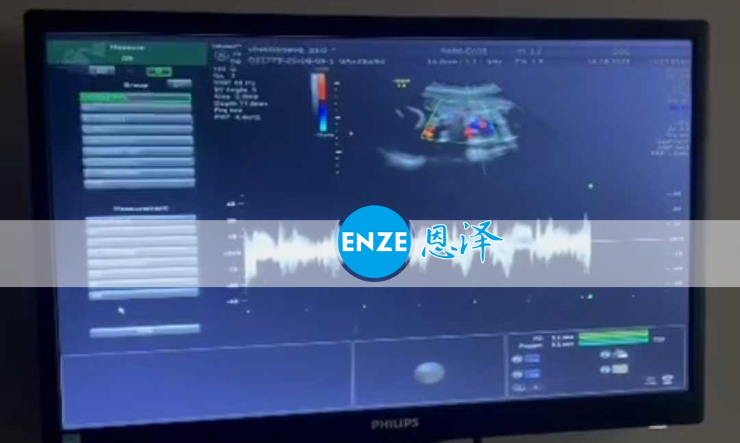 恩泽格鲁吉亚代孕代母25周检查顺利通过
