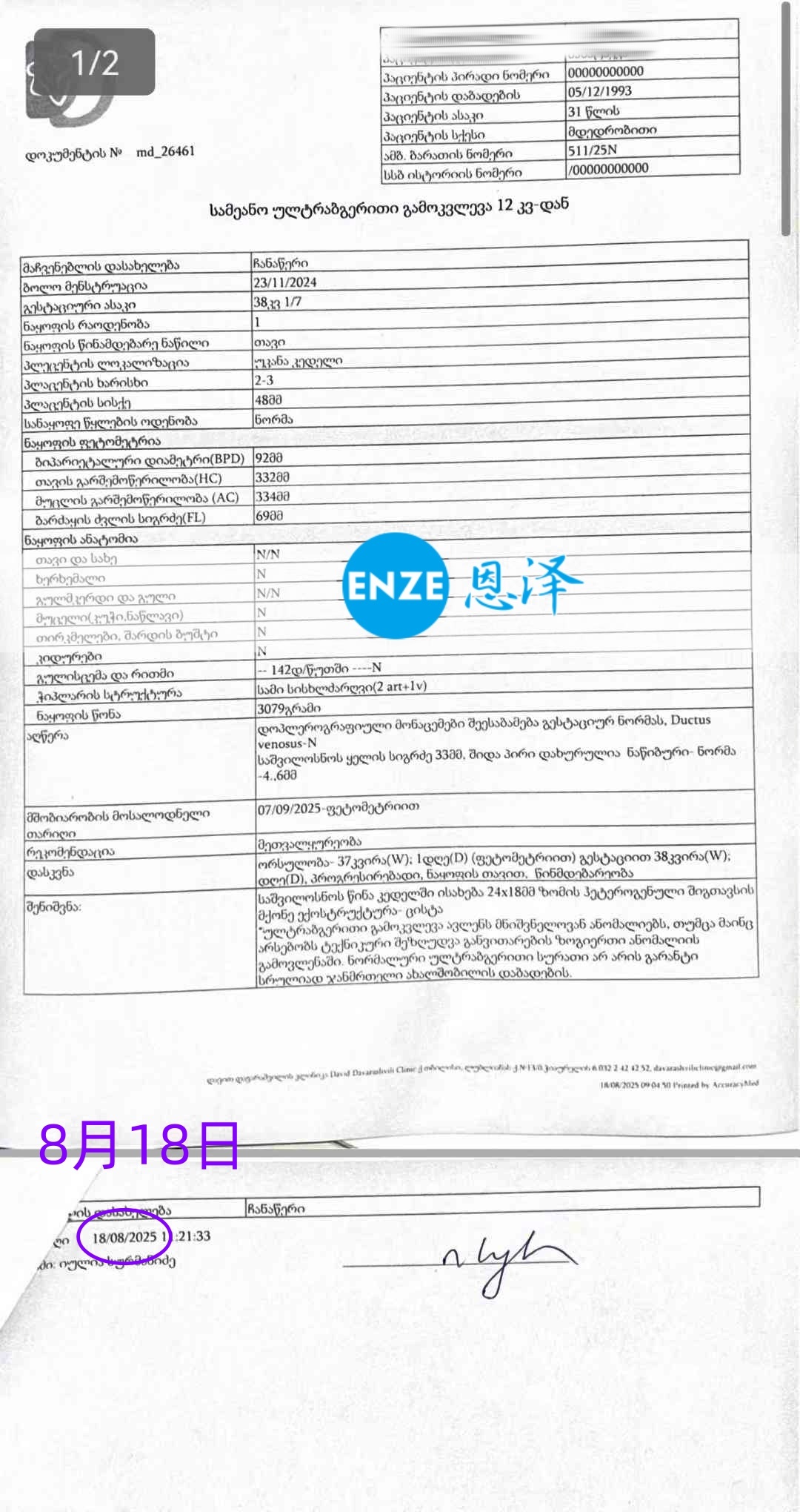 恩泽格鲁吉亚代孕代母38周检查顺利通过