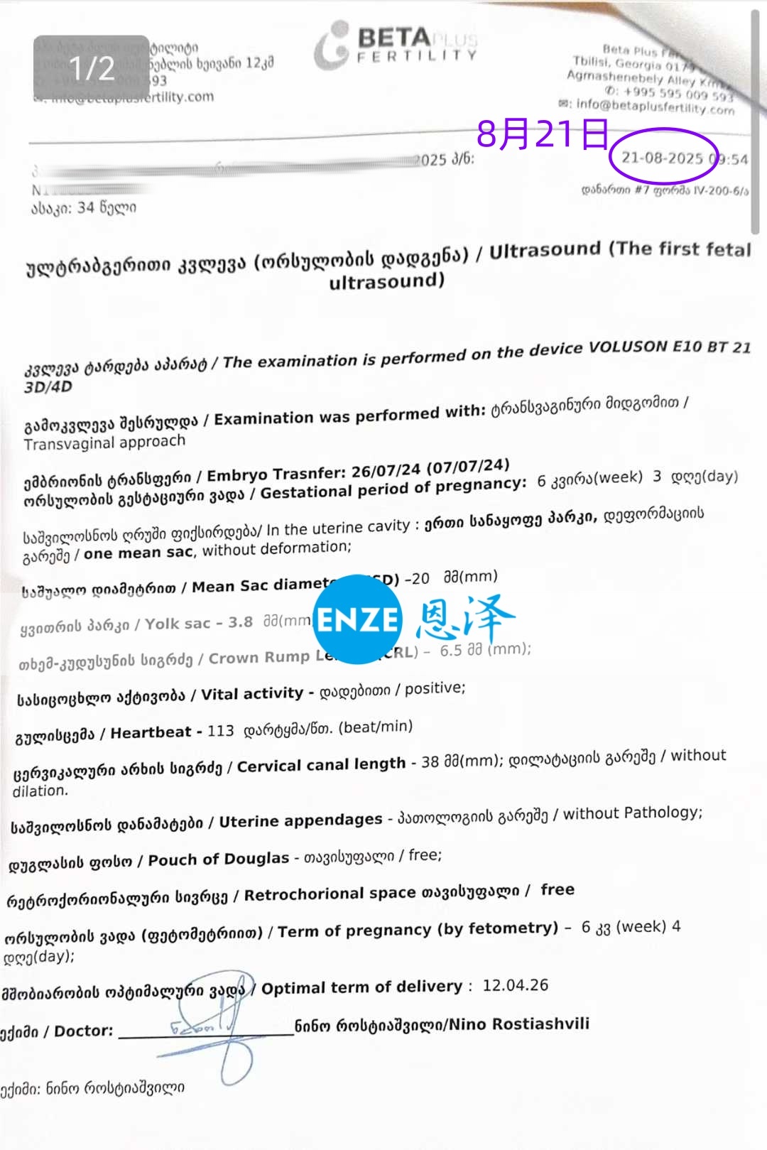 恩泽格鲁吉亚代孕代母21周检查顺利通过
