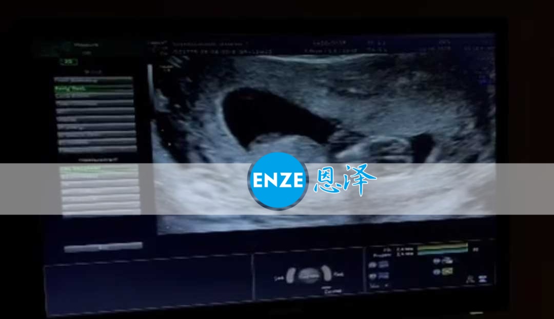 恩泽格鲁吉亚代孕代母11周检查顺利通过