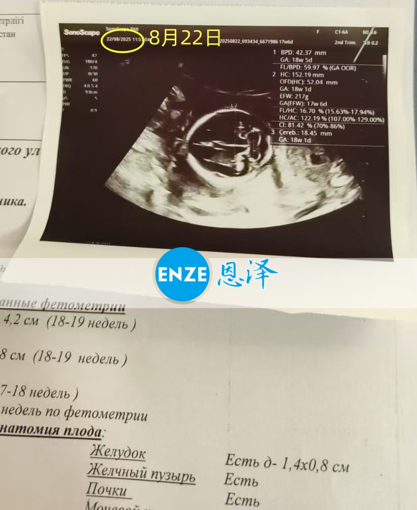 恩泽格鲁吉亚代孕代母18周检查顺利通过