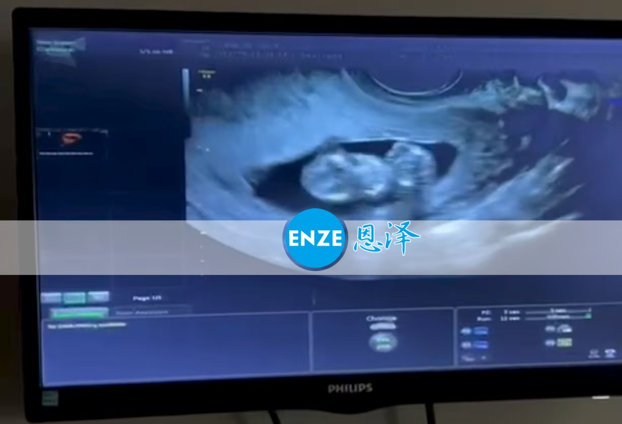 恩泽格鲁吉亚代孕代母11周检查顺利通过
