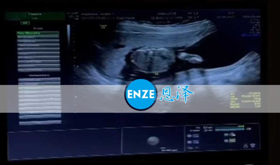 恩泽格鲁吉亚代孕代母17周检查顺利通过