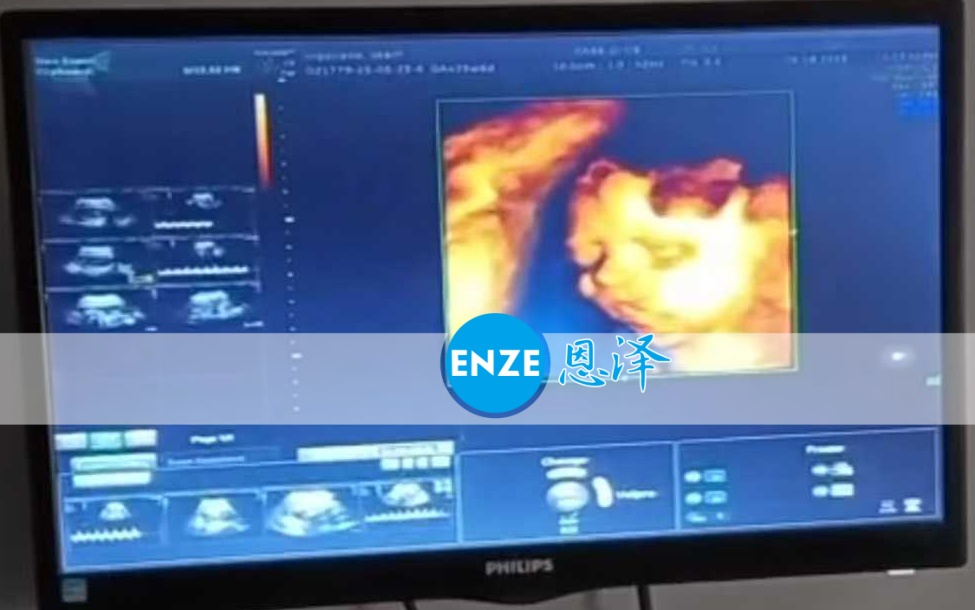 恩泽格鲁吉亚代孕代母25周检查顺利通过