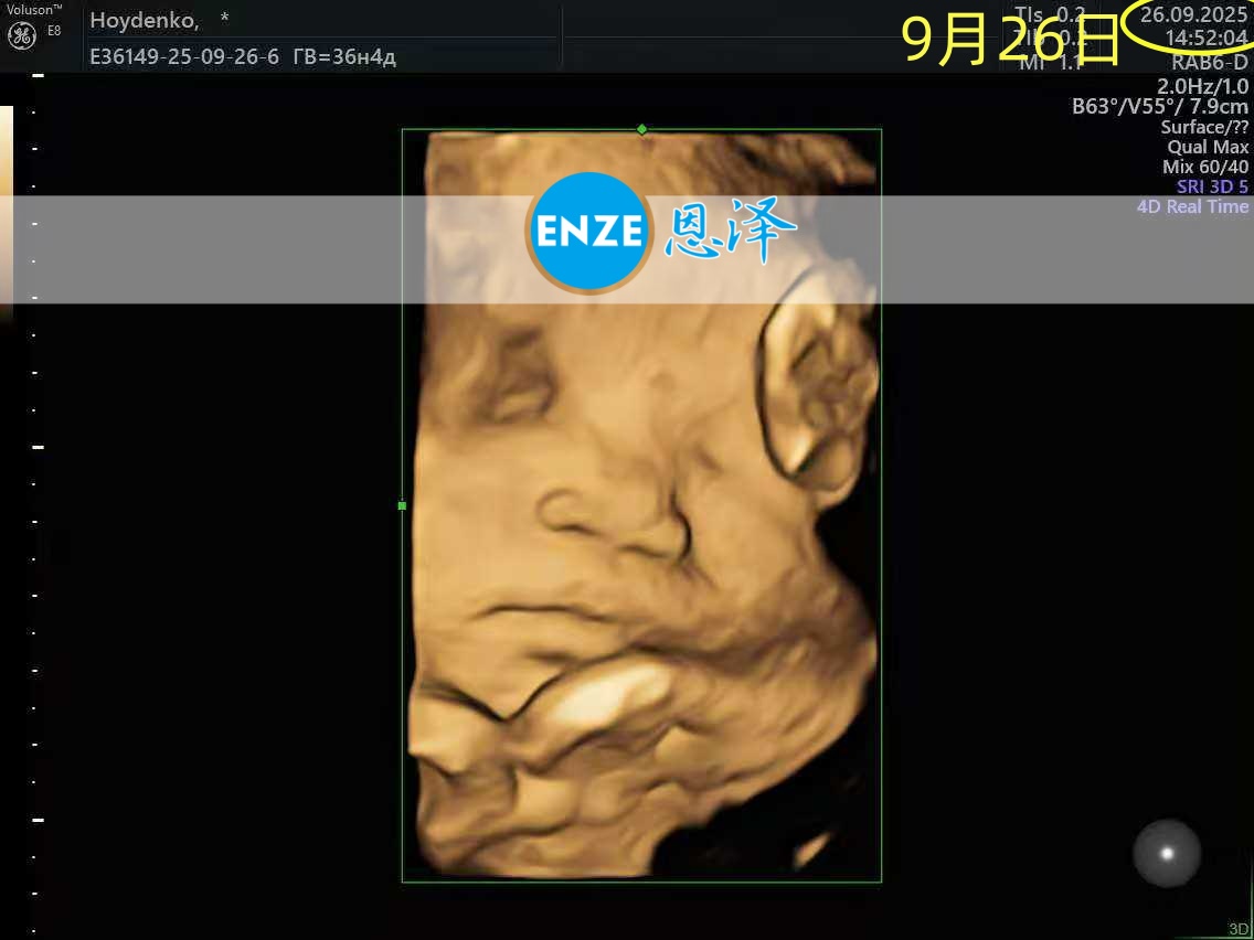 恩泽乌克兰代孕代母36周检查顺利通过
