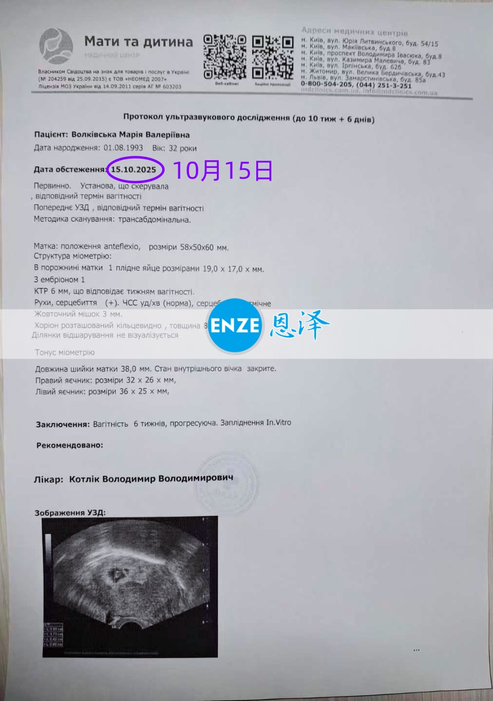 恩泽乌克兰代孕代母10周检查顺利通过