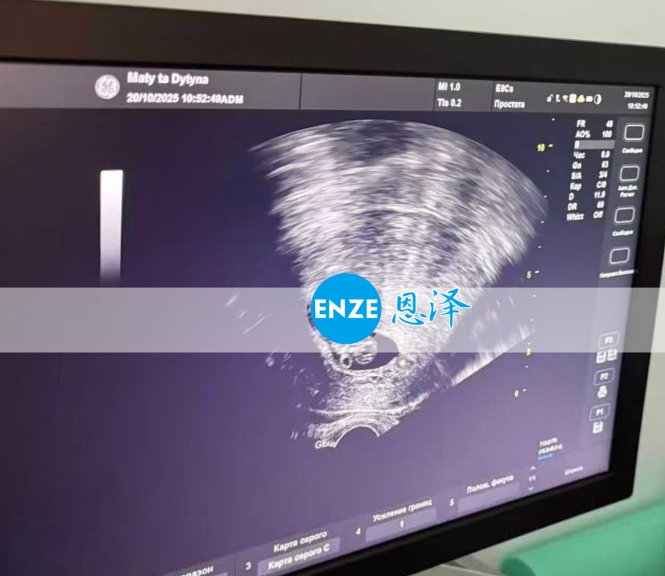 恩泽乌克兰代孕代母9周检查顺利通过