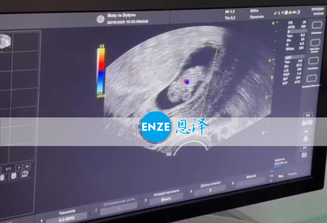 恩泽乌克兰代孕代母9周检查顺利通过
