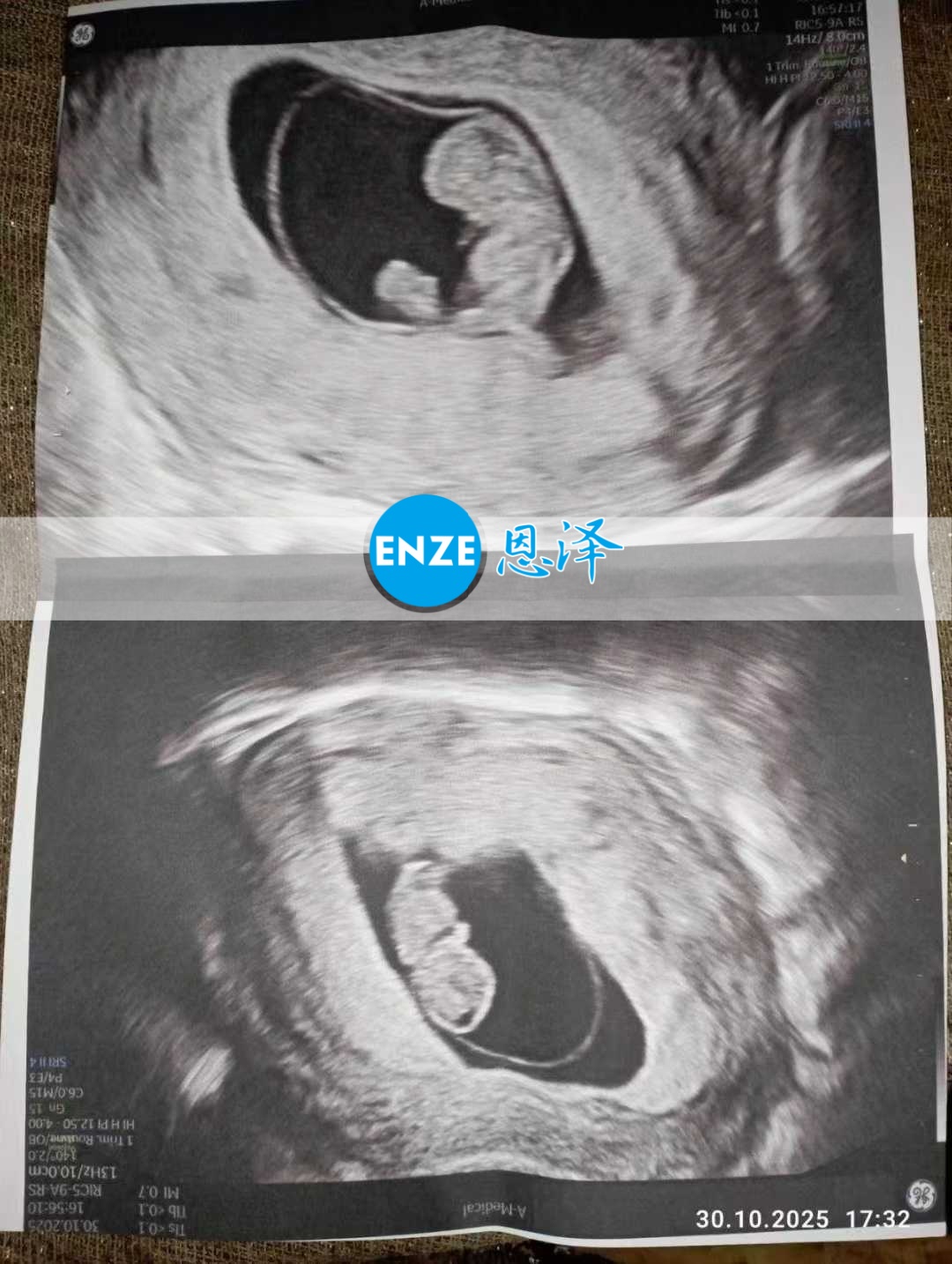 恩泽乌克兰代孕代母9周检查顺利通过