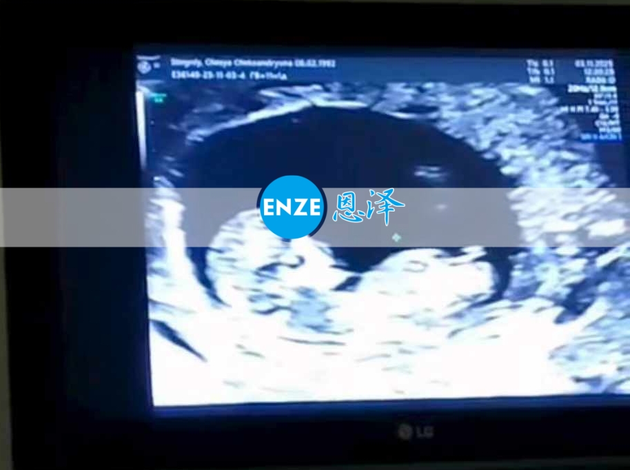 恩泽乌克兰代孕代母11周检查顺利通过