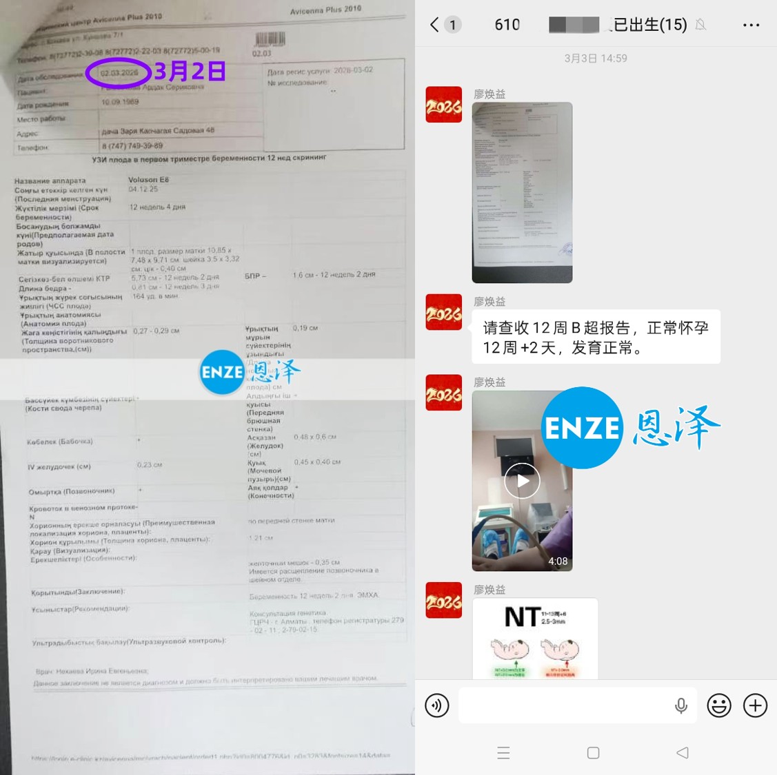恩泽格鲁吉亚试管婴儿代孕Chen先生捐卵15个月抱娃